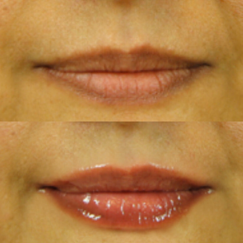 Stem Cell 3D Lip Enhancer | Free Radical Damage