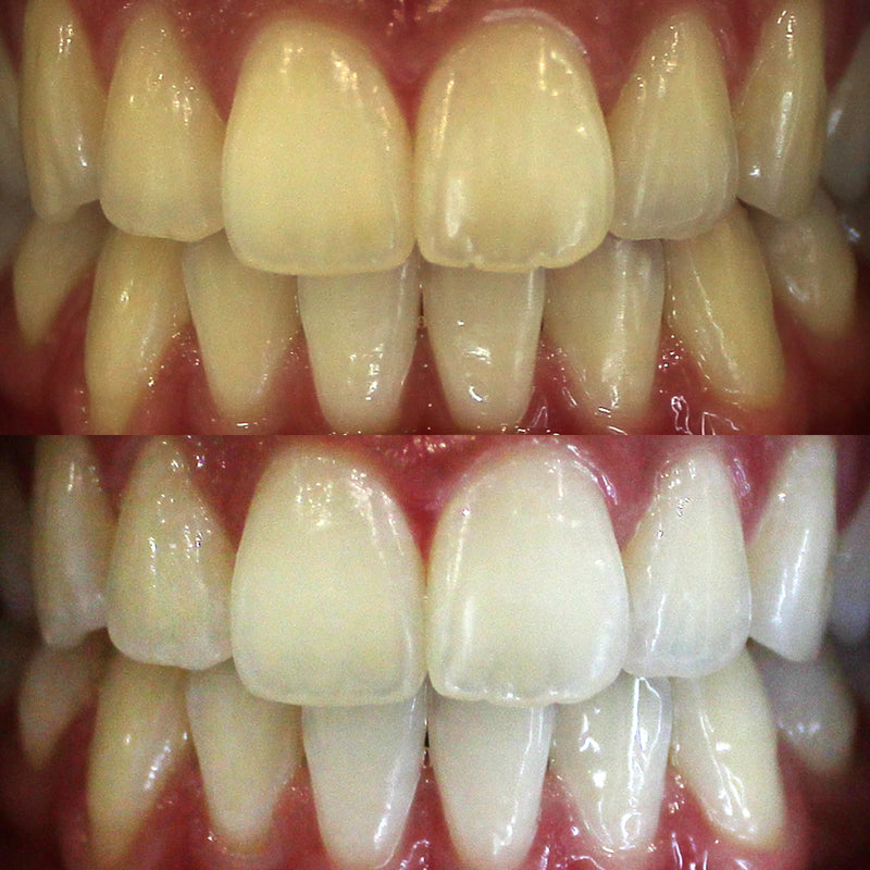 New Year Flash Sale!